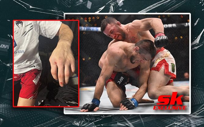 Exclusive: Coach gives savage response to fans belittling Merab Dvalishvili's win due to Umar Nurmagomedov's injury: "Don't break your hand next time"