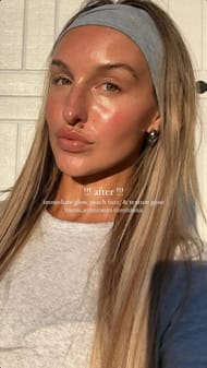 McCall Smith's post-treatment look (Source: @mccallkelli via Instagram)