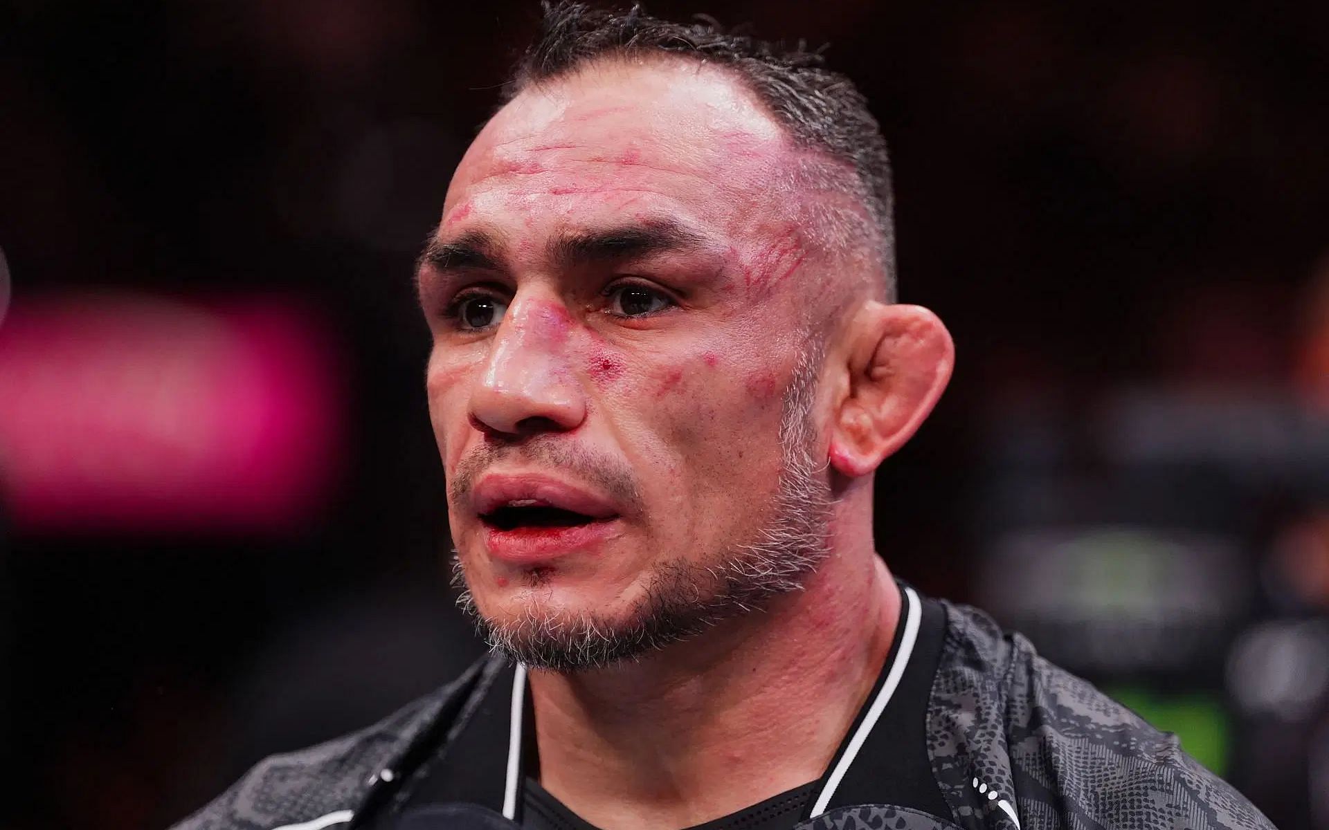 Tony Ferguson