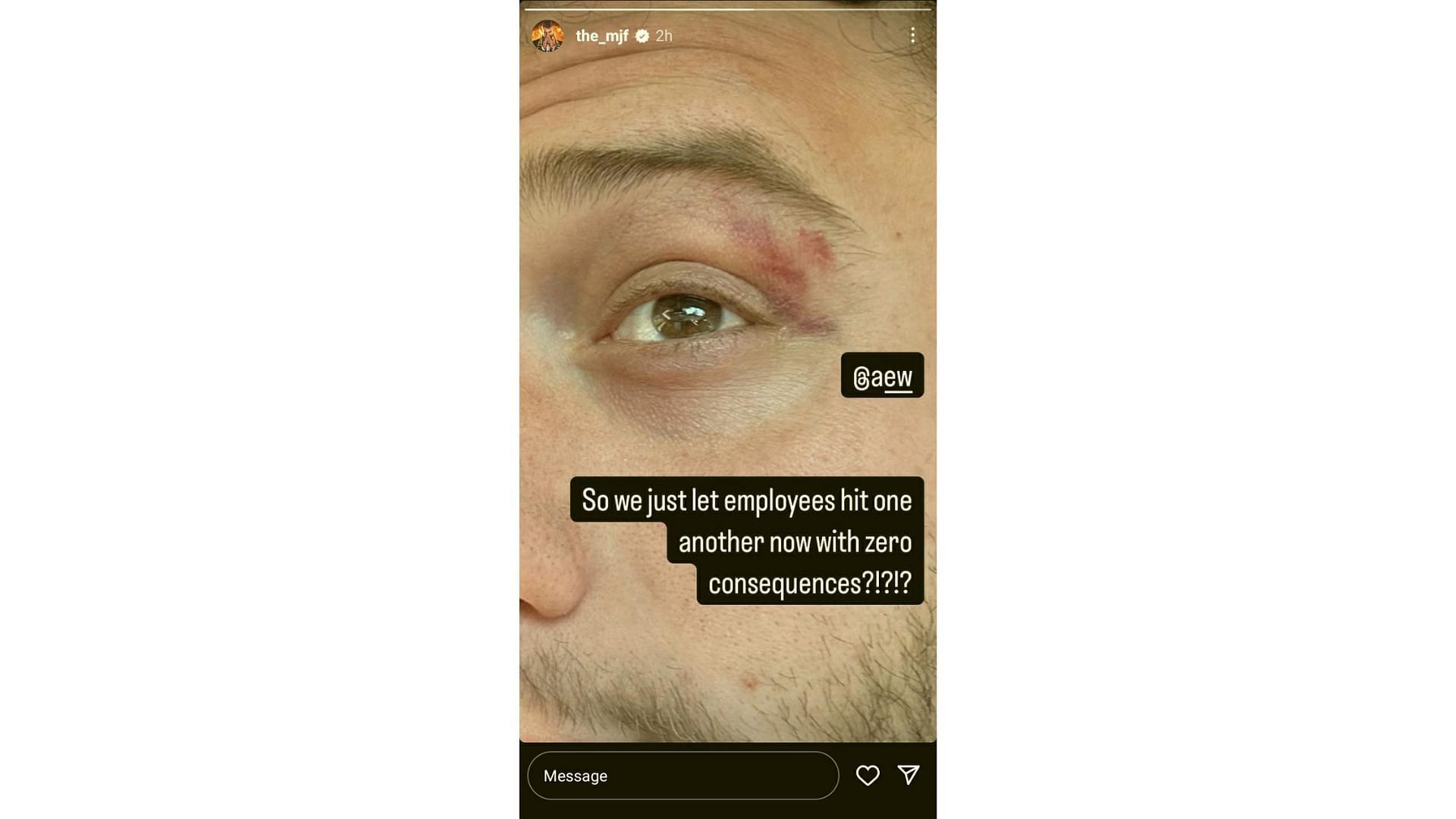 MJF sent a message to AEW about incidents from this week&#039;s Dynamite [Source: Friedman&#039;s IG story]