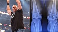 Is Stone Cold Steve Austin preparing for a WWE in-ring return? All you need to know after his recent knee replacement surgery