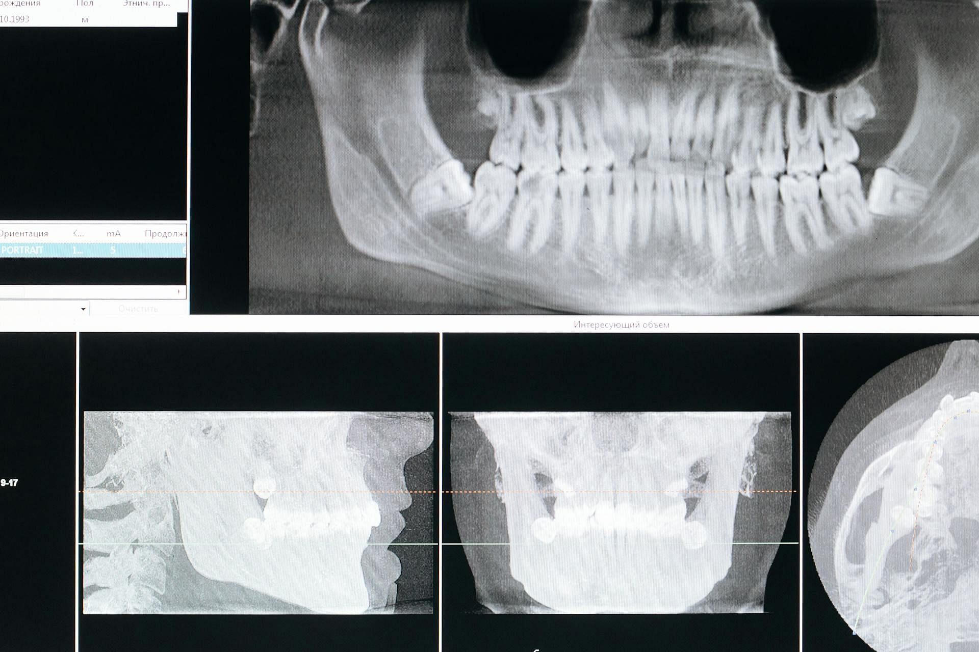 Dateline: Unforgettable Sherri had fractured skull and jaw (Image via Pexels)