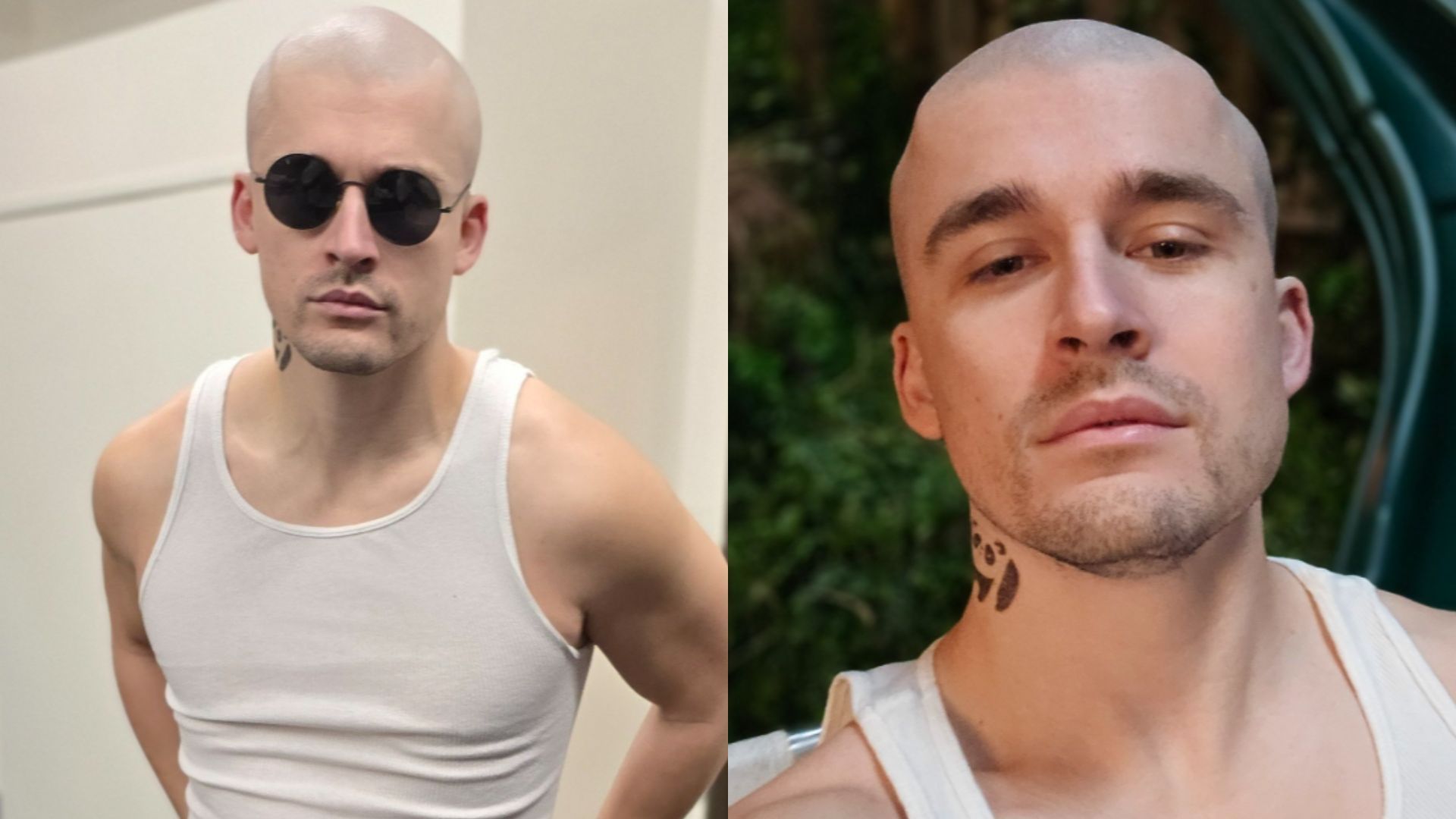 Fans troll Ludwig after he shaved his head on stream