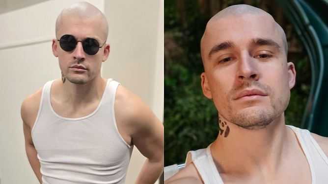 Fans troll Ludwig after he shaved his head on stream