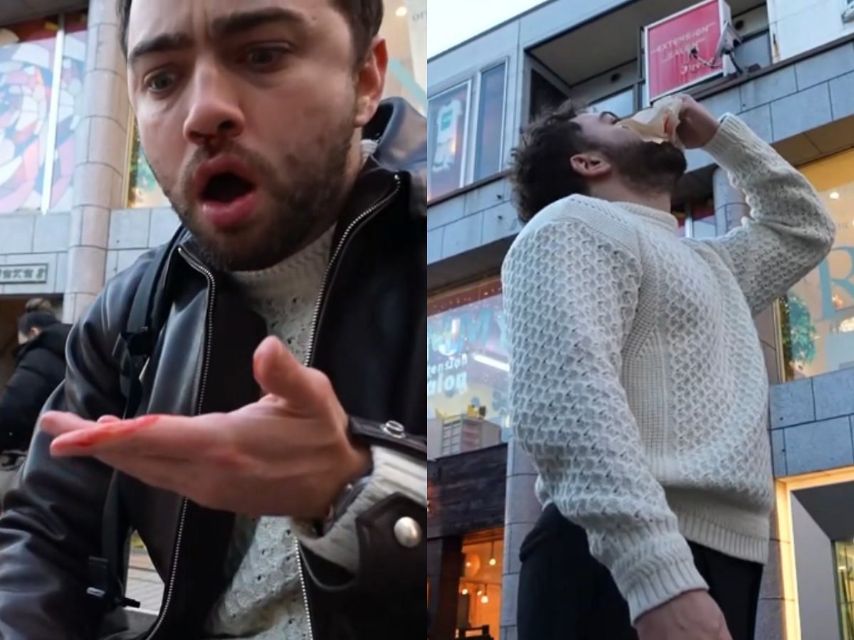 Mizkif bleeds from his nose during his Japan trip (Image via Twitch/@Mizkif)