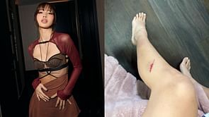 “I’m genuinely worried” — Internet reacts to BLACKPINK’s Lisa getting injured at the ‘Born Again’ MV filming set