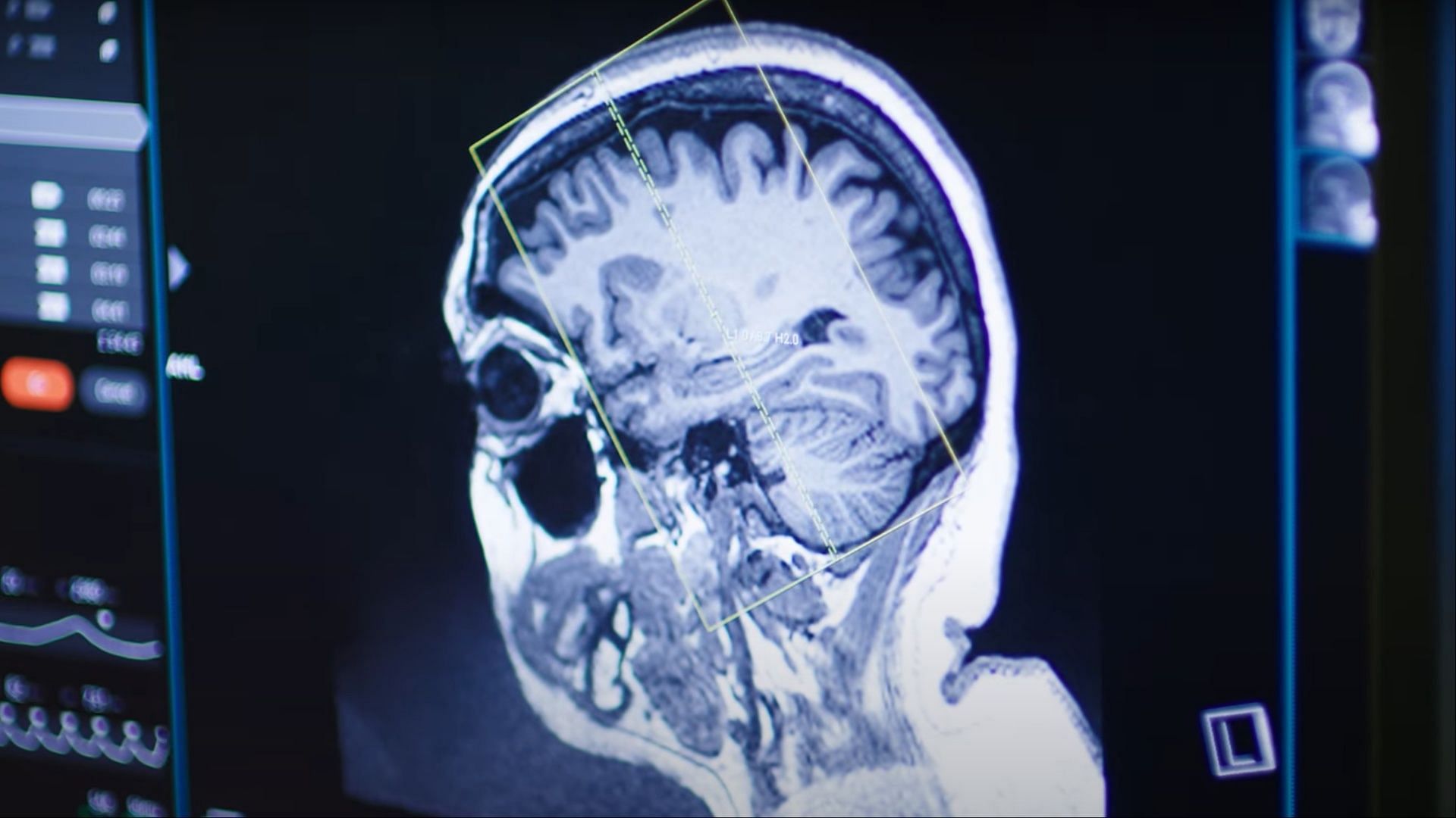 A clip from the docuseries shows Pillay&#039;s medical scan. (Image via Prime Video Canada)