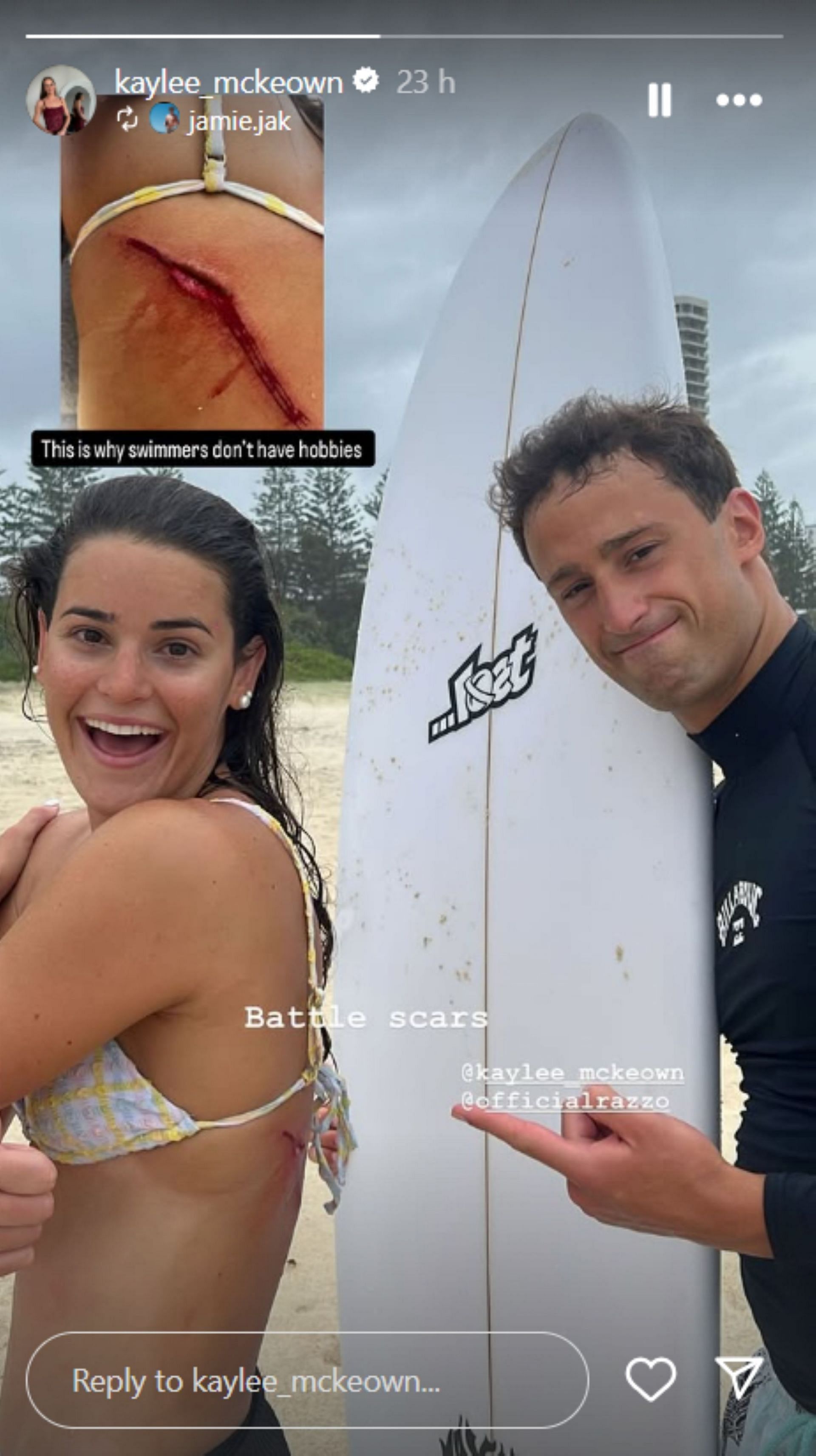 Kaylee McKeown shows her scar from surfing; Instagram - @kaylee_mckeown