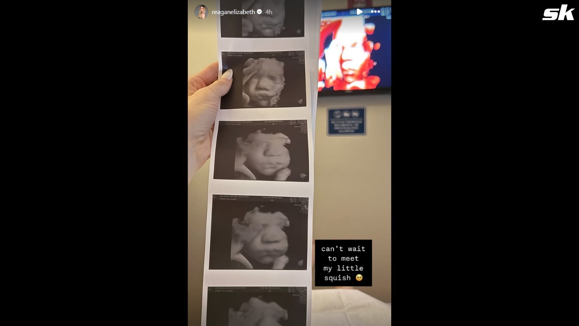 Alex Bregman&#039;s wife Reagan reacts to ultrasound photos (Image via Instagram/@reaganelizabeth)