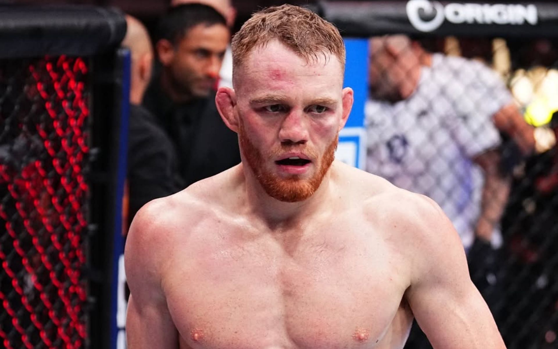 Jack Della Maddalena talks about his nose. [Image courtesy: @ufccanada on Instagram]