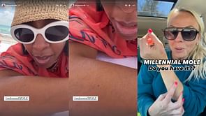What is the Millennial Mole forearm conspiracy? Kelly Rowland weighs in on viral theory