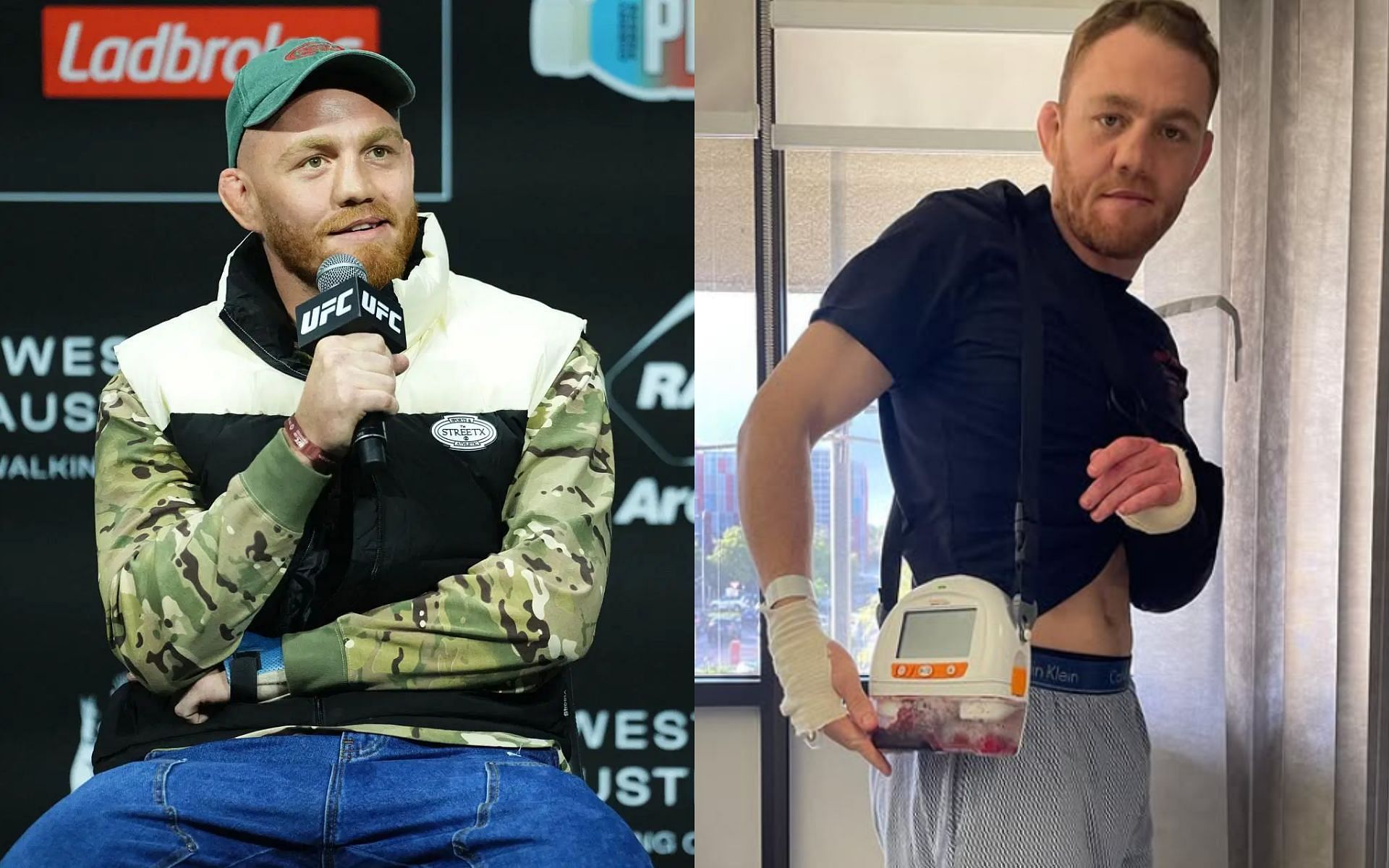 Jack Della Maddalena (left) opens up on nearly losing his arm after breaking it at UFC 299 and requring surgery (right) [Images courtesy: Getty Images, @jackdellamaddalena on Instagram]