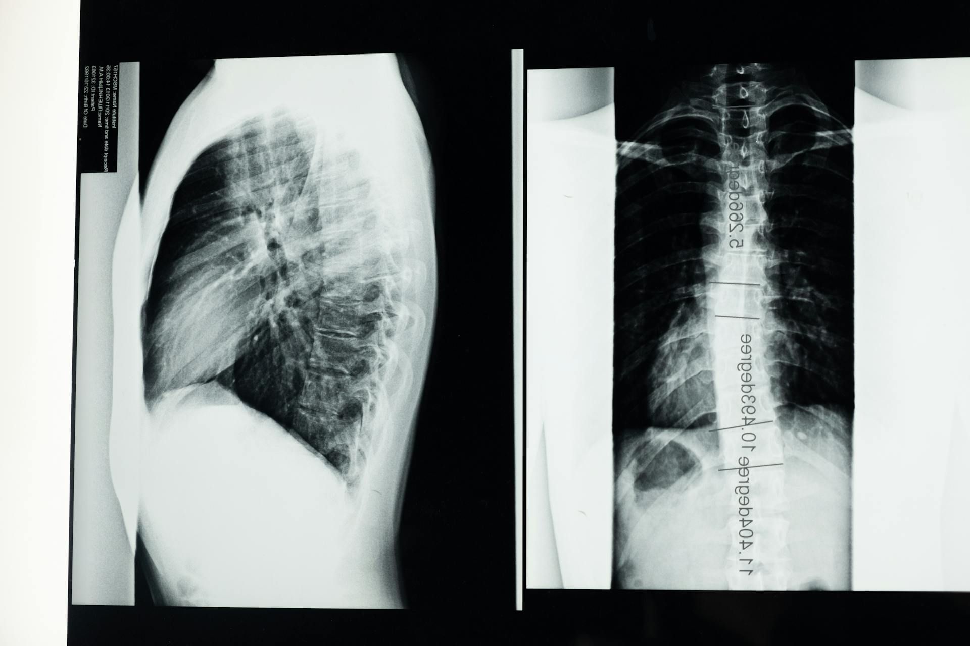 Austopsy reports revealed that the victim died due to the two chest wounds. (Image via Pexels)