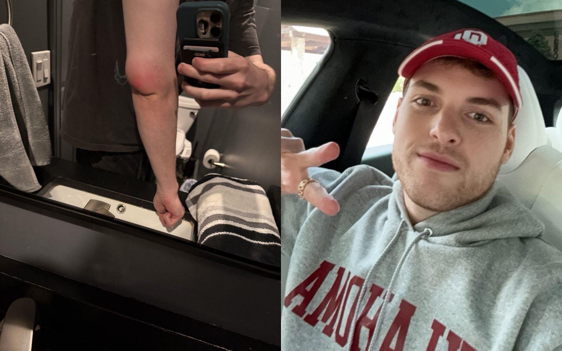 &quot;It looks crazy&quot;: Fans concerned as Dream opens up about &quot;massive swelling bump&quot; on his elbow