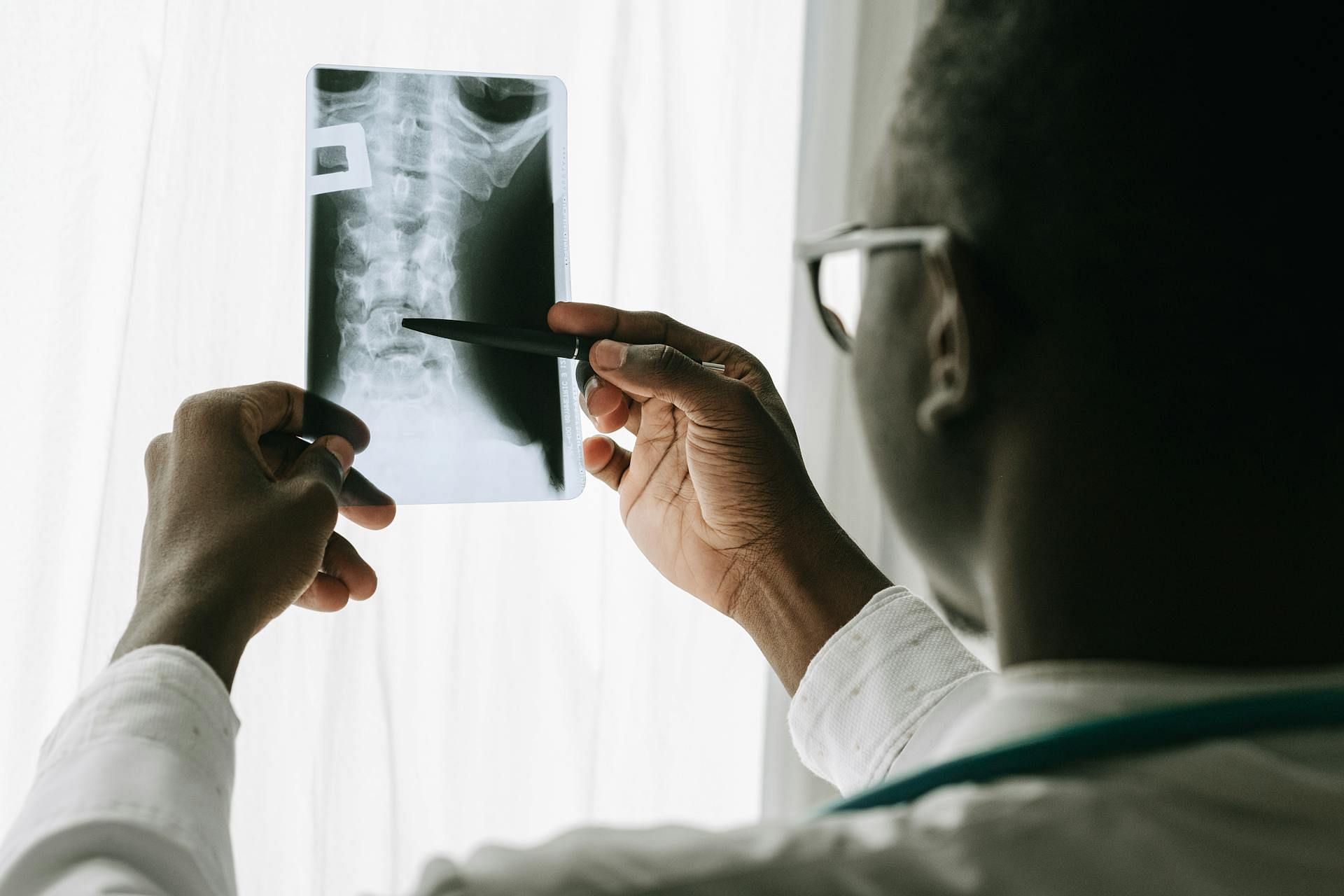 Delliah Zamora&#039;s body had a broken Larynx (Image via Pexels)