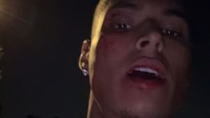 Twitch streamer Marlon allegedly gets attacked outside his home