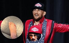 Coach breaks silence on Merab Dvalishvili's concerning toe injury ahead of UFC 316
