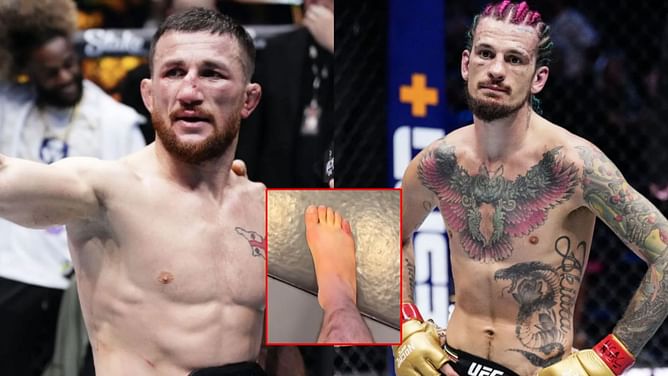 Ex-UFC champ baffled by Merab Dvalishvili’s gruesome toe injury days before Sean O'Malley rematch: "I don't know how a kick can do that"