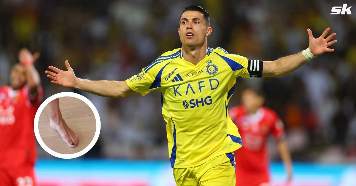 Why does Cristiano Ronaldo paint his toenails black? 