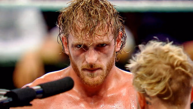 Logan Paul is injured; says how it happened