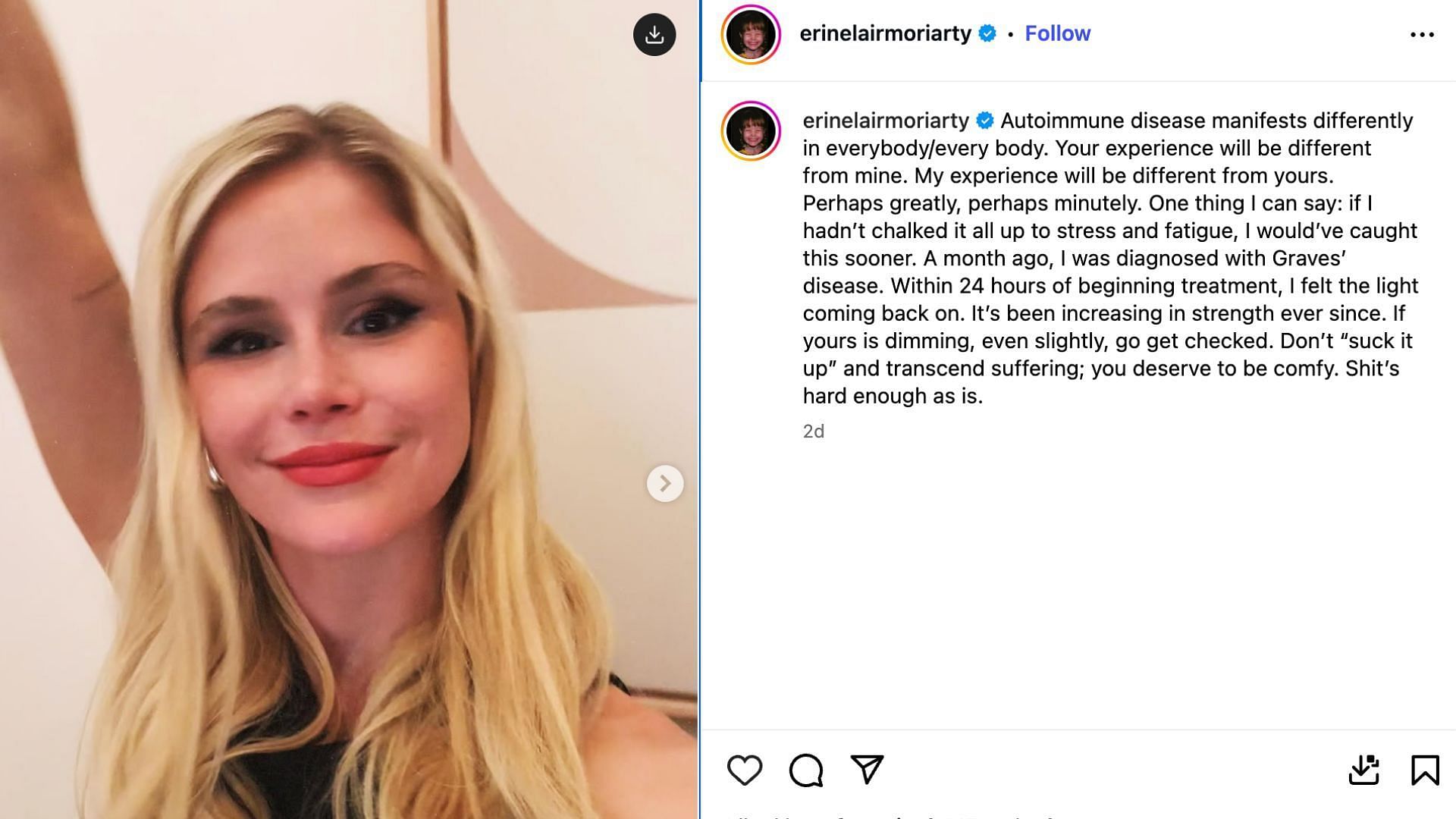 Erin Moriarty on her autoimmune disease (Image via Instagram/@erinelairmoriarty)