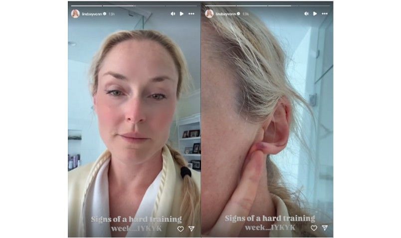 Screenshots of Lindsey Vonn&#039;s Instagram story | Source: IG/lindseyvonn