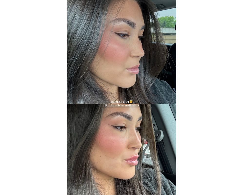 Dillon Gabriel&rsquo;s fianc&eacute;e Zo Caswell reveals &ldquo;before &amp; after&rdquo; lip filler glow-up in latest IG post [IG/@zo.caswell]