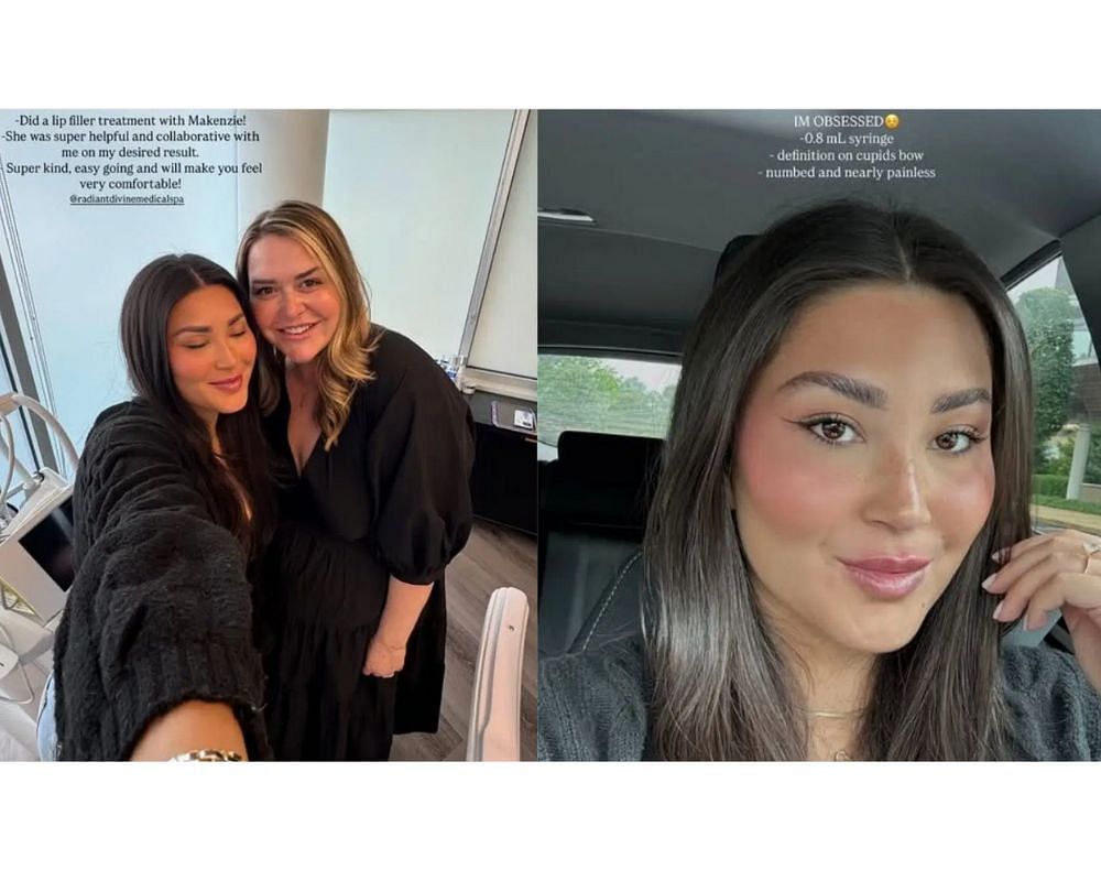 Dillon Gabriel&rsquo;s fianc&eacute;e Zo Caswell reveals &ldquo;before &amp; after&rdquo; lip filler glow-up in latest IG post [IG/@zo.caswell]