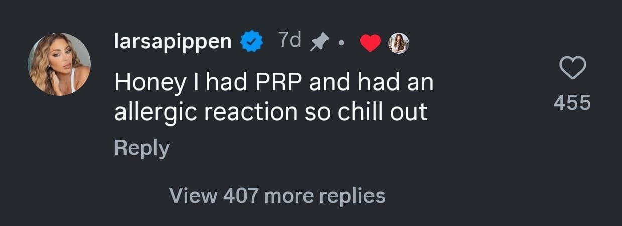 Larsa Pippen&#039;s reply to claims of her face being &quot;overfilled&quot;