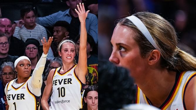 "Officially have a batman on the team": Fever fans react after Lexie Hull's unmissable black eyes from Sparks game go viral