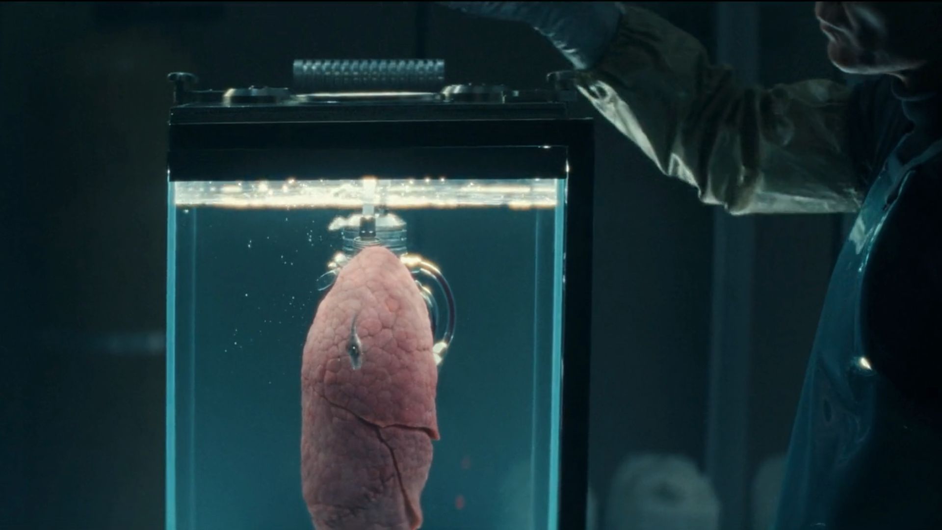 Hermit&#039;s lung (Image via Hulu)