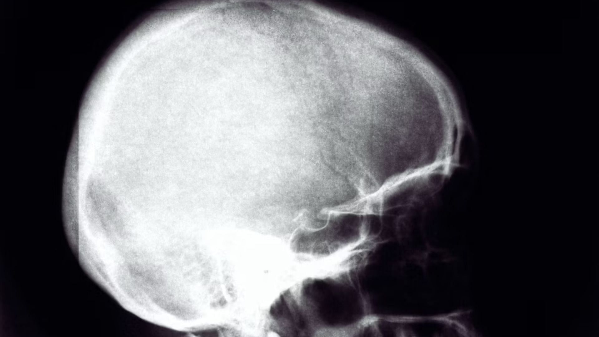 A second set of X-rays revealed no fractures to the skull (Image via Unsplash)
