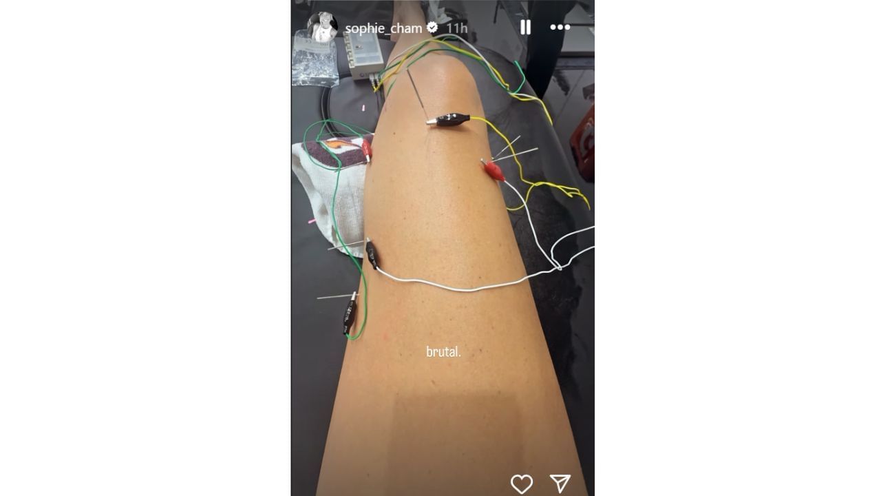 Sophie Cunningham says electrotheraphy to rehab from an MCL injury is &quot;brutal.&quot; [photo: @sophie_cham/IG]