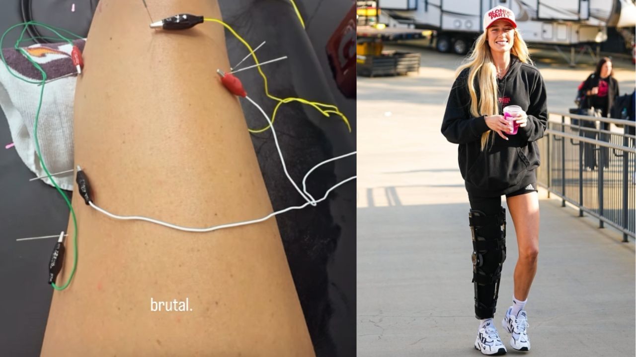 &quot;Brutal&quot;: Sophie Cunningham reveals agony after experiencing excruciating pain during treatment to activate paralyzed muscles. [photo: @sophie_cham/IG, @indianafever/IG]