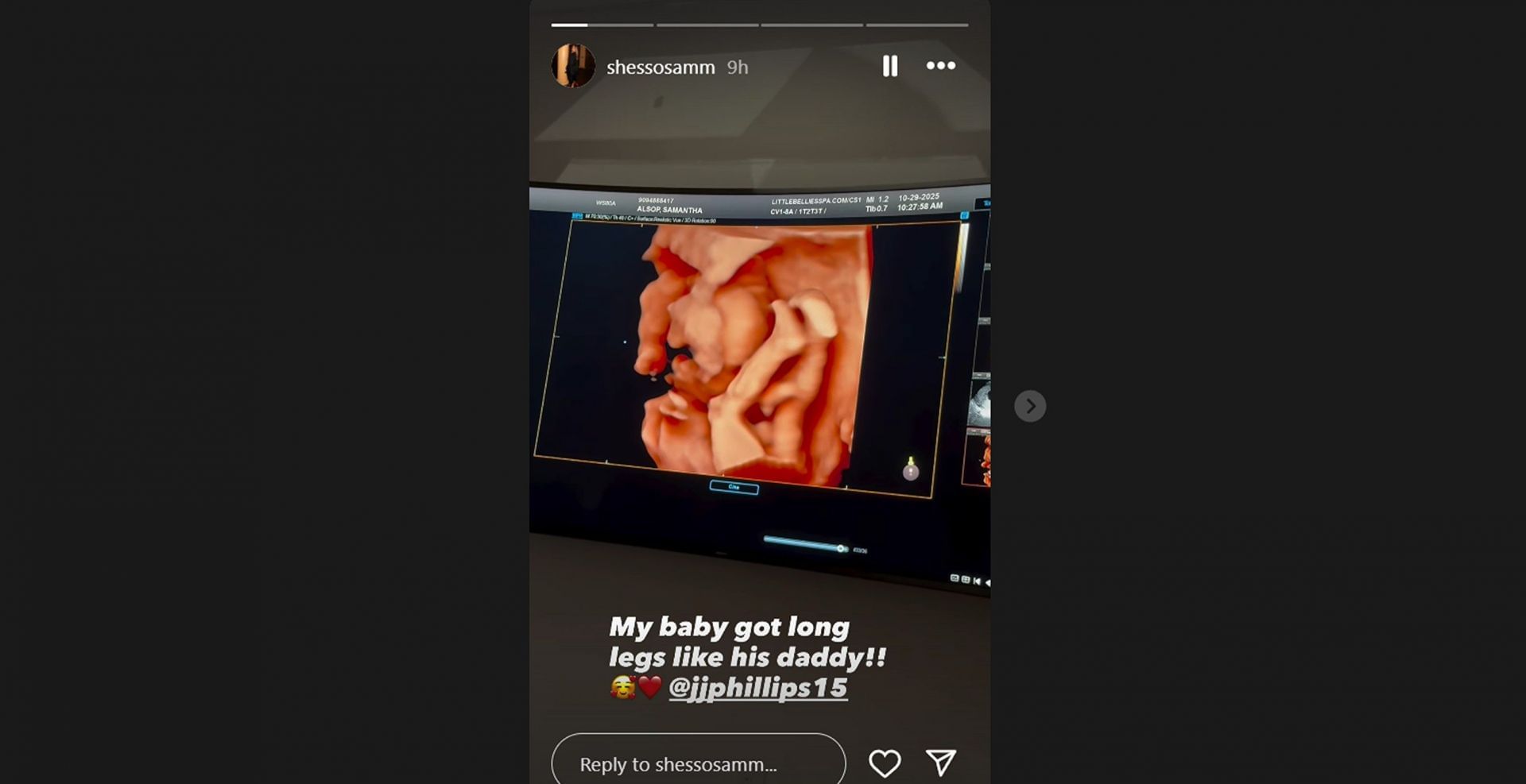 Jaelan Phillips&#039; fianc&eacute;e Samantita Bonita/@shessosamm