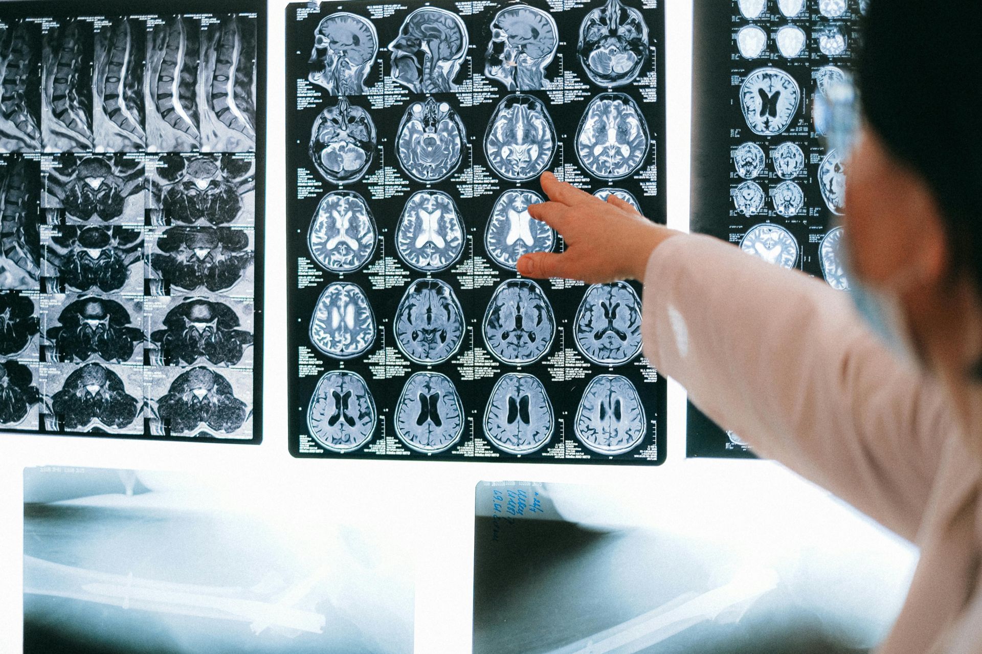 A neurologist conducted sleep studies for the defense (Image via Pexels)