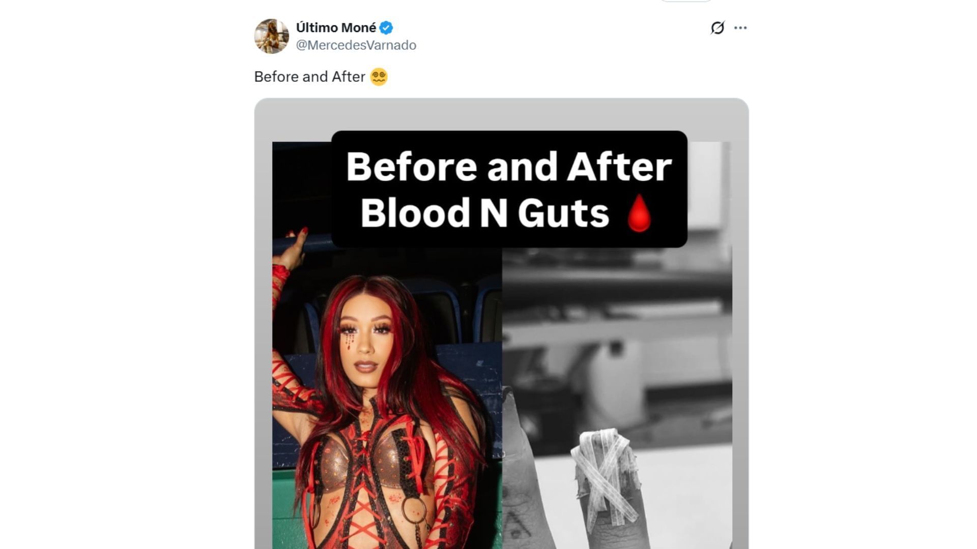 Mercedes Mone shows off her &quot;injuries&quot; after Blood and Guts [Source : Mone&#039;s X profile]