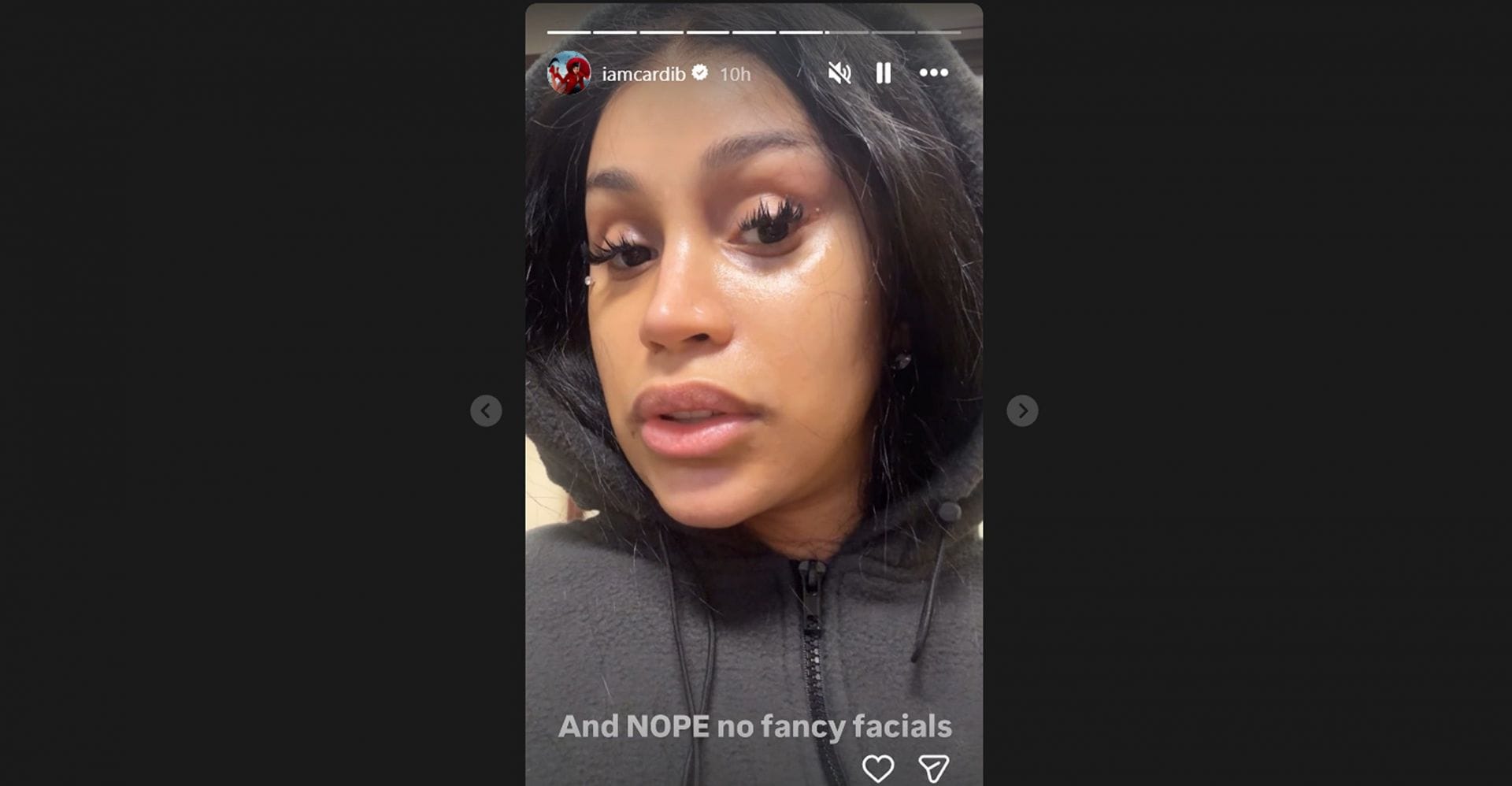 Stefond Diggs&rsquo; GF Cardi B reveals her face&rsquo;s biggest problem while showing off no-makeup look/@iamcardib