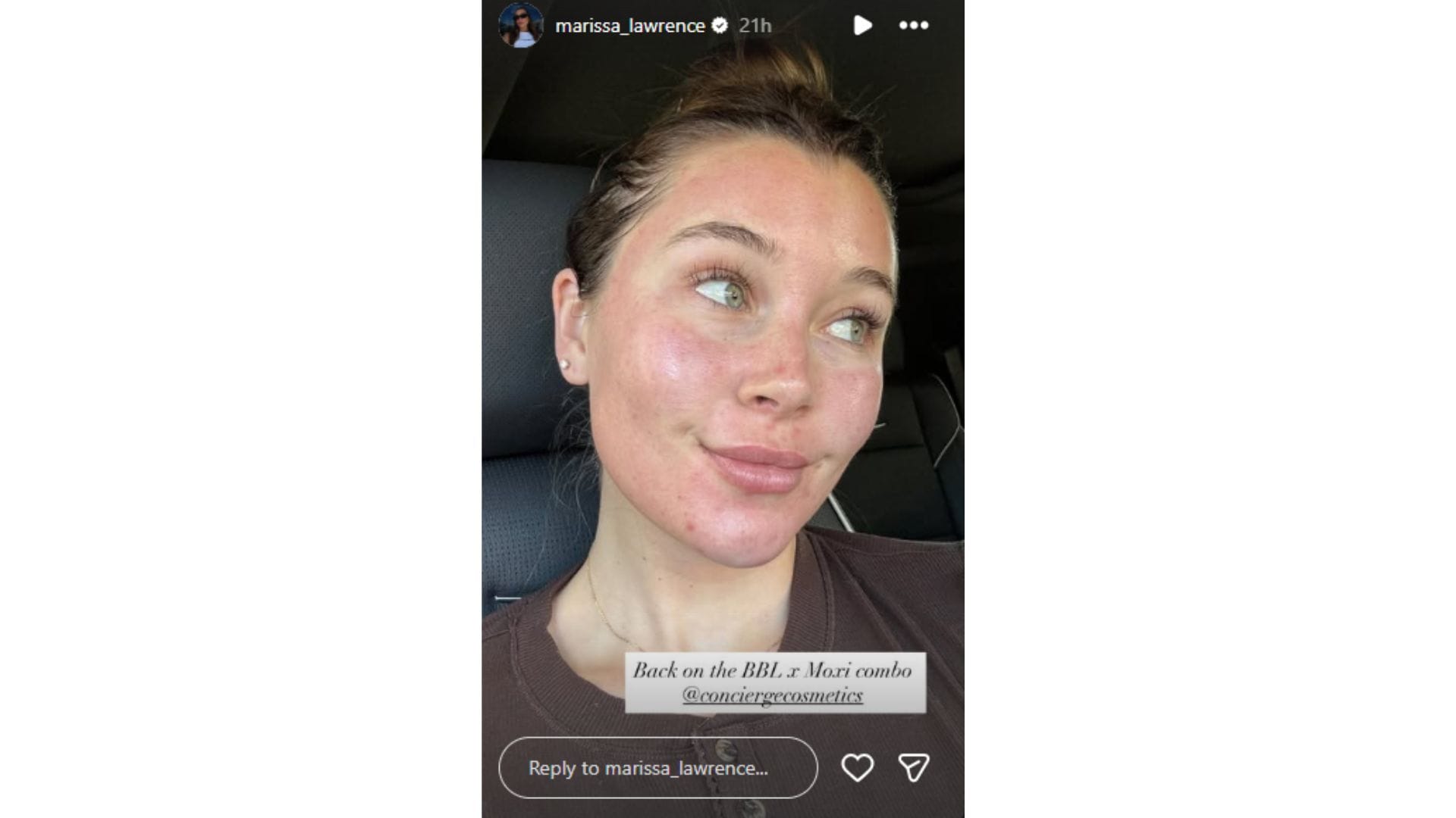Marissa Lawrence gave an update on her skincare routine. (Credit: @marissa_lawrence)