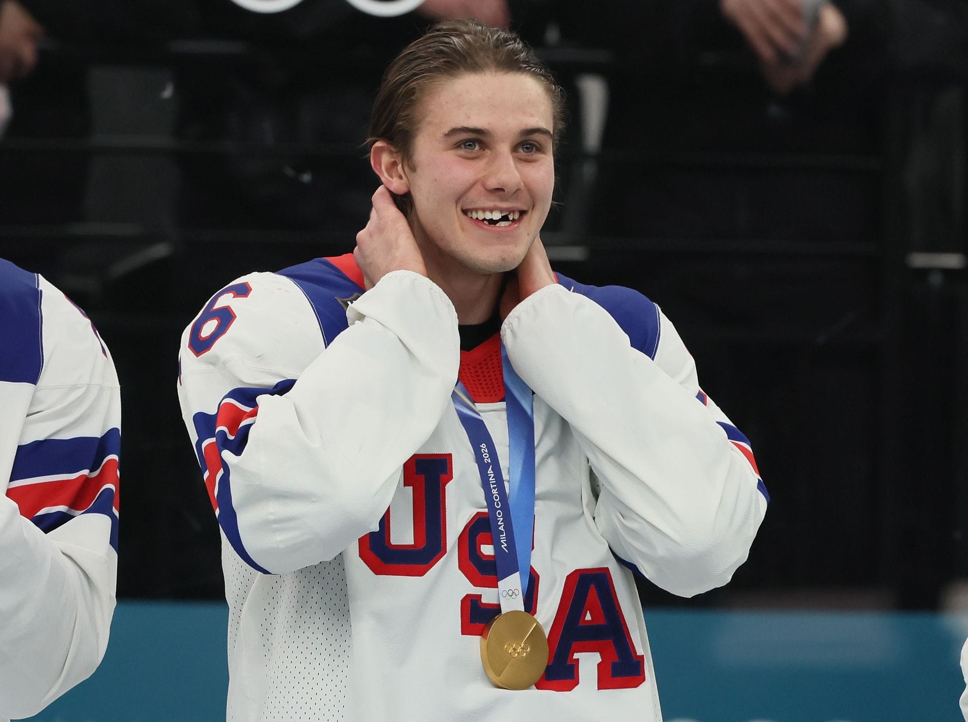 Jack Hughes finally fixes broken teeth sustained in USA'S Olympic gold medal game