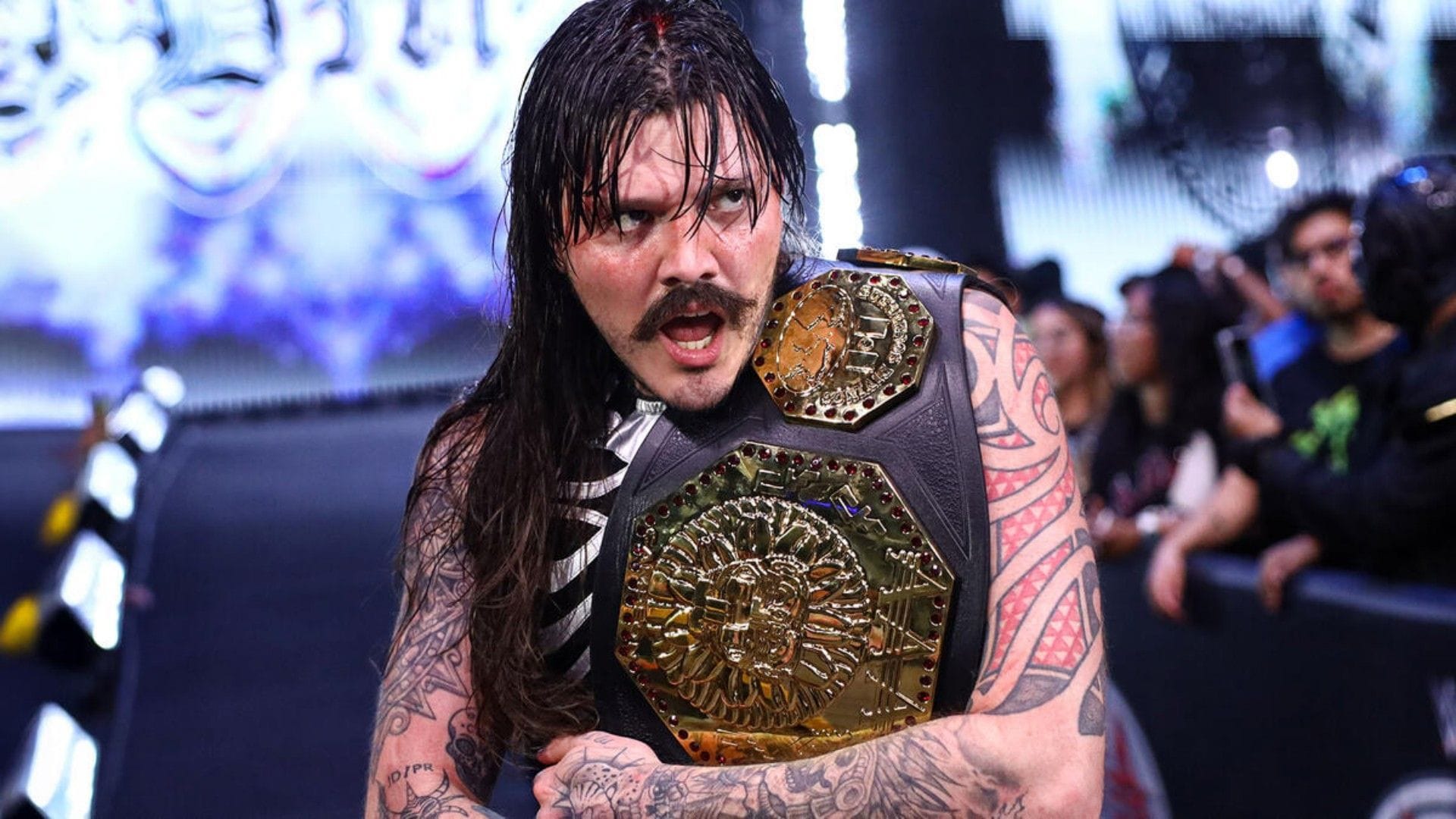 Dominik Mysterio details recent graphic injury; he still has an issue