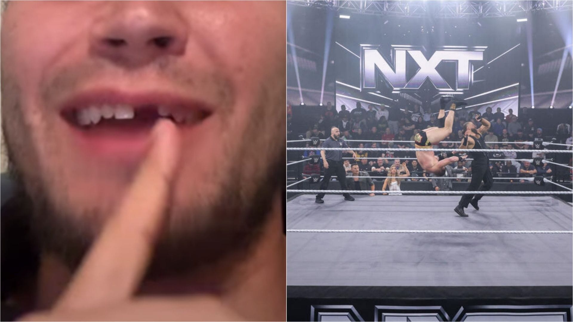 Watch: WWE star gets his tooth knocked off in gruesome spot on TV