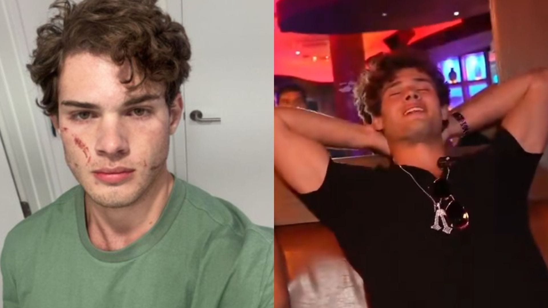 "That was brutal": Clavicular breaks silence after reportedly overdosing live on stream