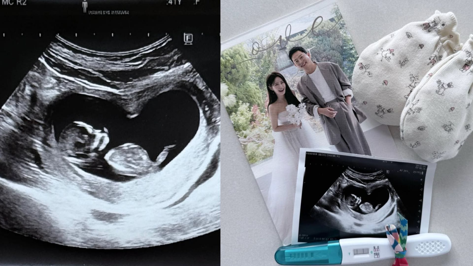 When did Kim Jimin and Kim Junho get together? Relationship timeline explored as couple expects first child after undergoing IVF process