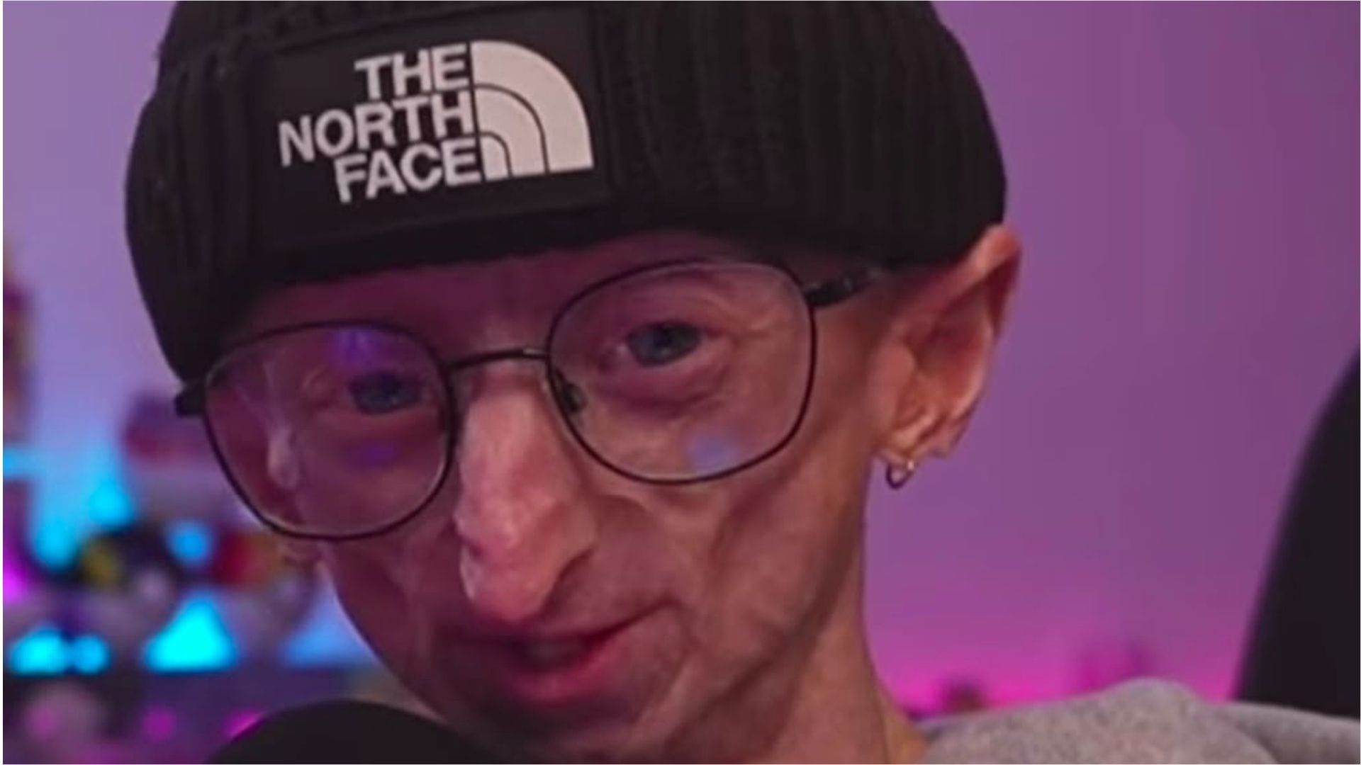 Who was Michiel Vandeweert? Influencer reportedly dies at 28 due to rare rapid aging disorder