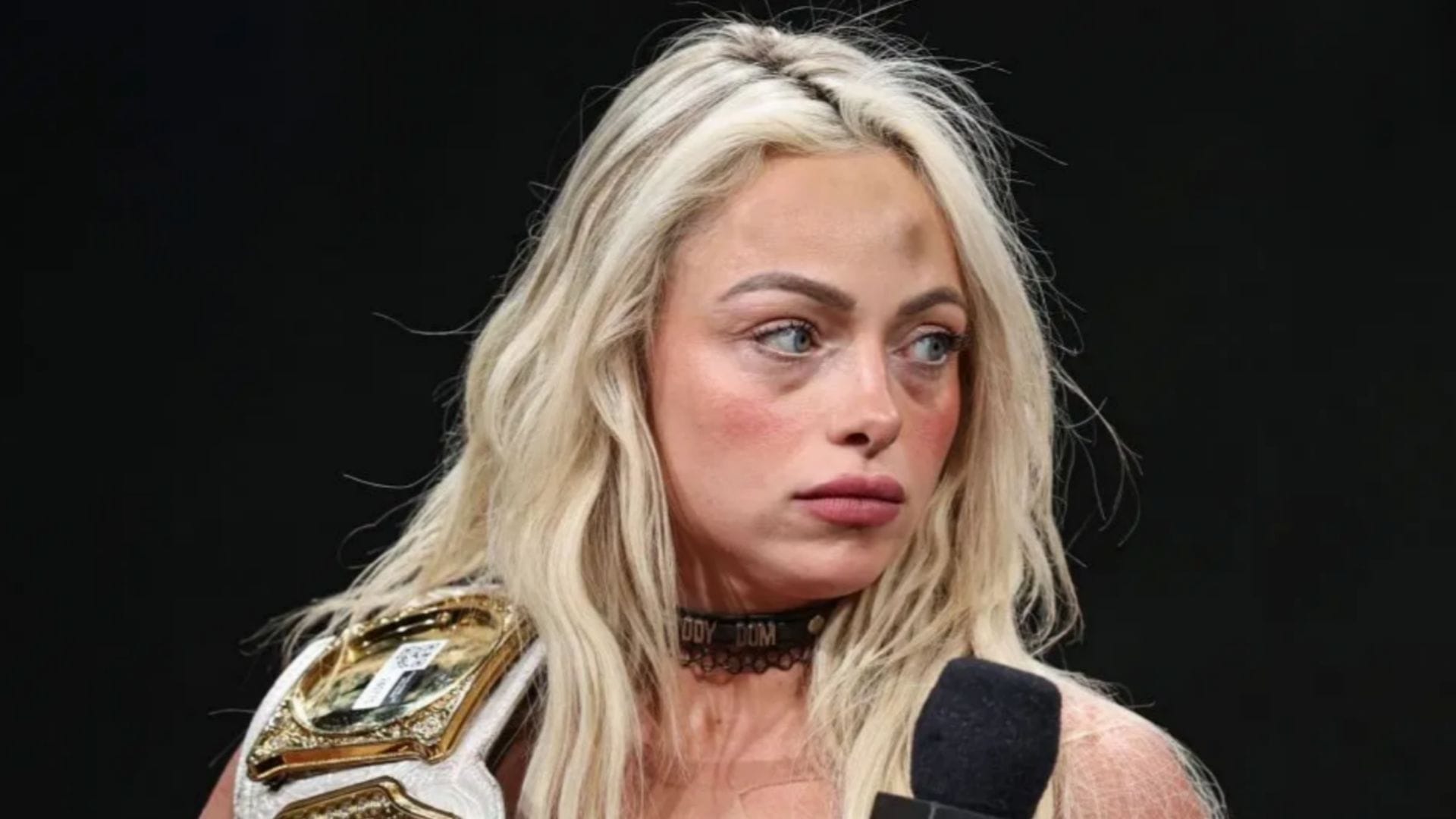 "Hopefully, she doesn't need surgery" - WWE Women's World Champion Liv Morgan dealing with injury, says close friend