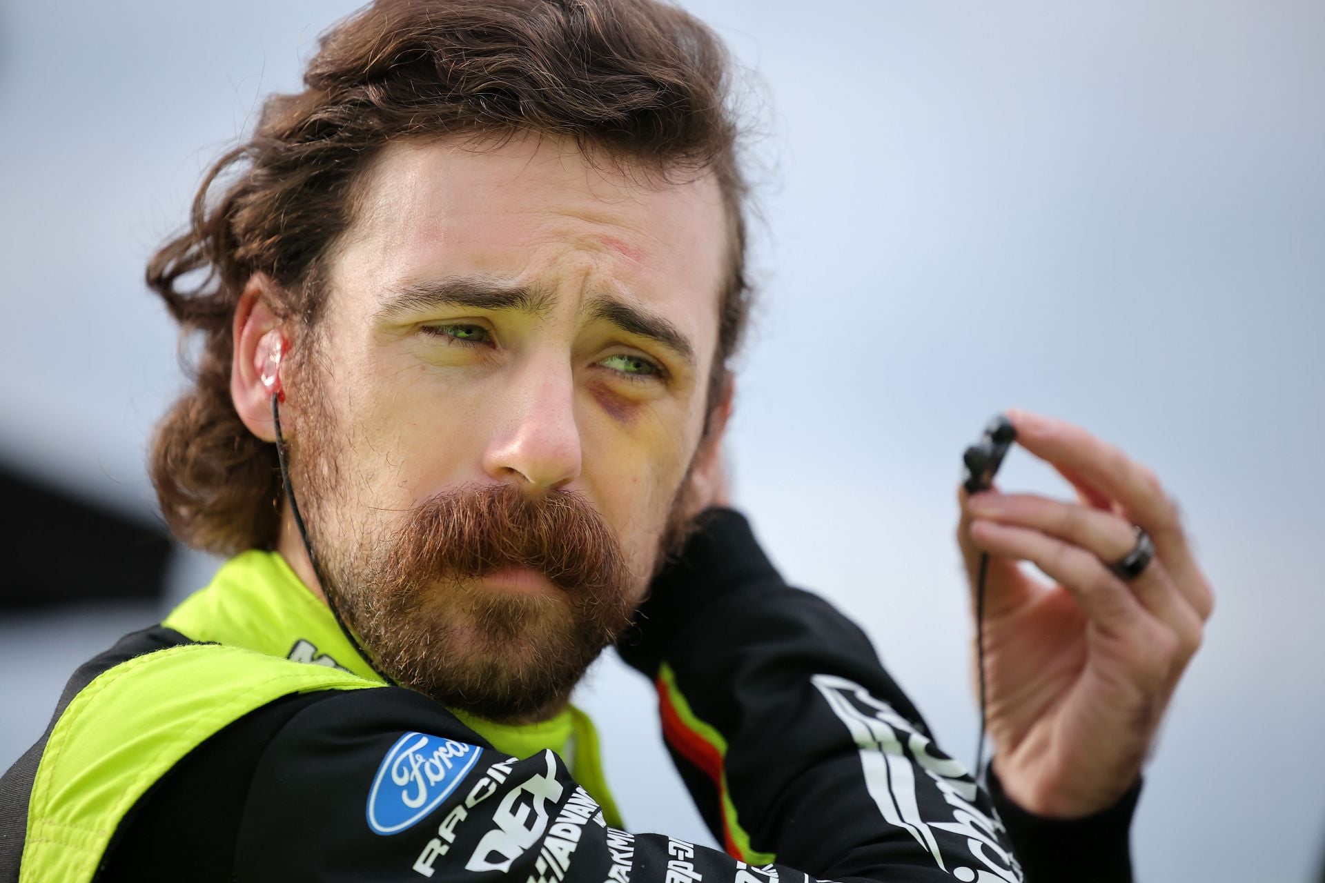 Ryan Blaney drops update on black eye from Carson Hocevar’s punch: “Wish it healed quicker”