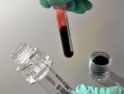 Photo illustration shows a blood sample taken for sports doping analysis