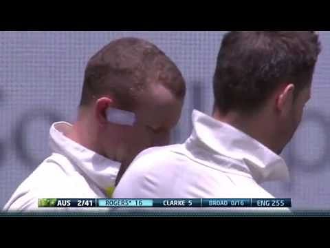 Stuart Broad's bouncer hits Rogers' head