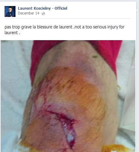 Arsenal defender Laurent Koscielny's knee injury not as serious as reported